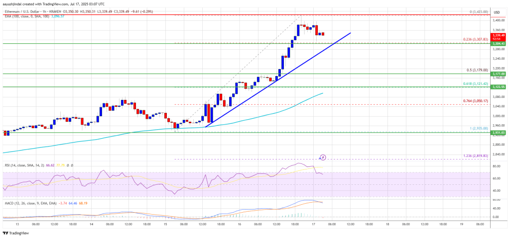 ethereum_5b7365 Ethereum Price